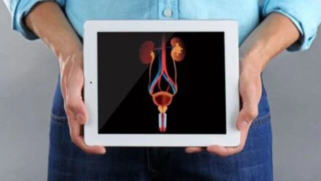 Vasectomía (imagen ilustrativa)