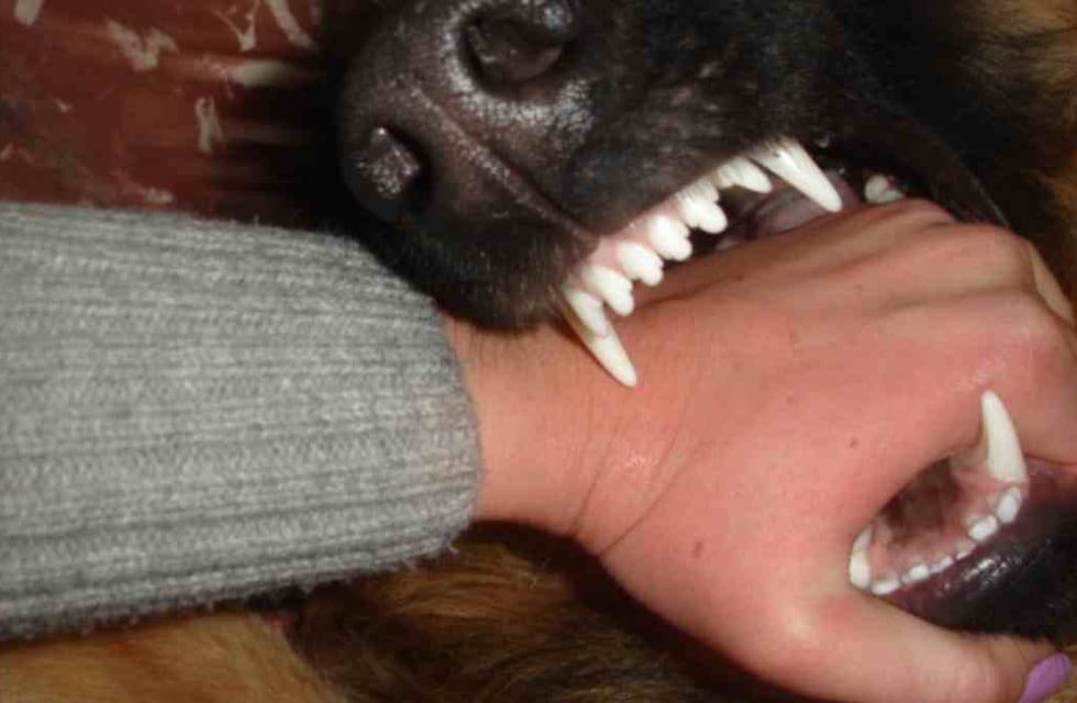 La mataron sus perros: una mujer de Pilar murió tras las mordeduras de sus mascotas