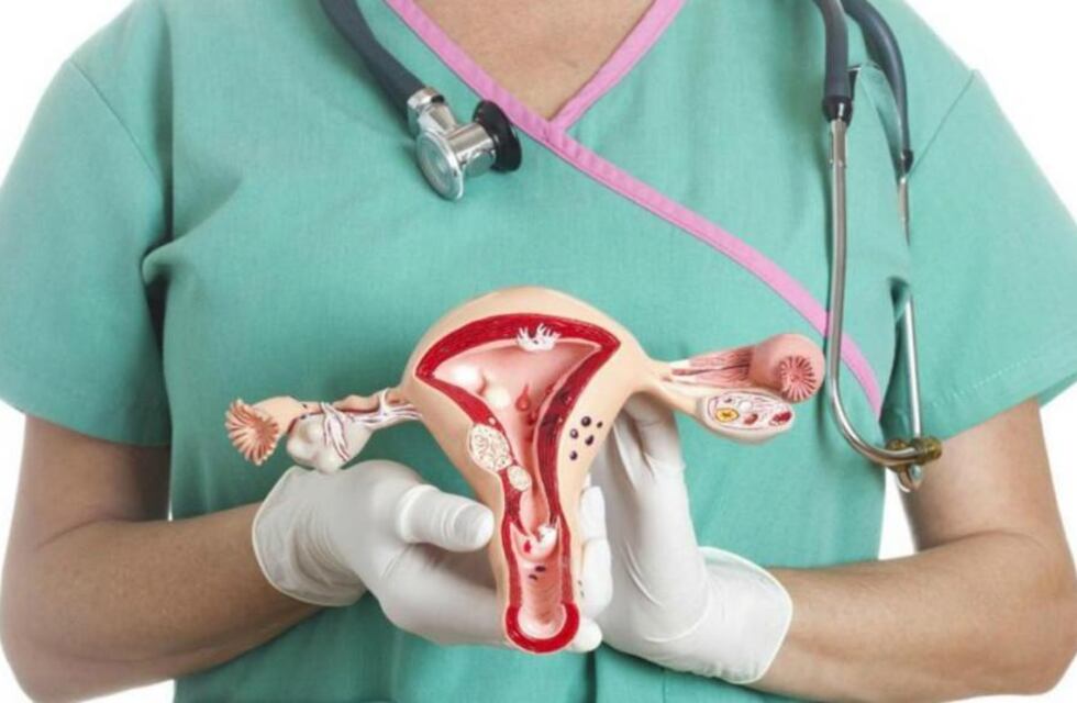 Día Mundial del Cáncer de Ovario: cómo reconocerlo para tratarlo a tiempo