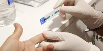 En el Día Nacional de la Prueba de VIH, el Ministerio de Salud Pública recordó que los test son gratuitos, confidenciales y fundamentales para detectar precozmente.
