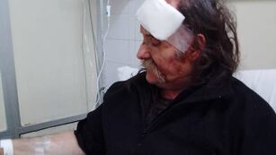 Daniel González recibió 15 puntos de sutura al caerle una bola en la cabeza.