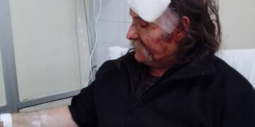 Daniel González recibió 15 puntos de sutura al caerle una bola en la cabeza.