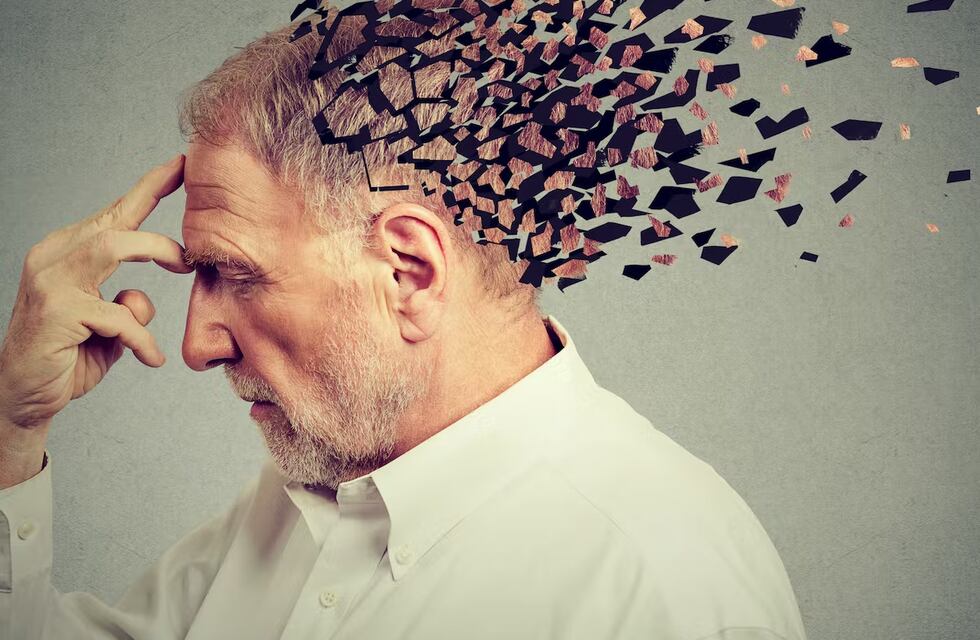 Lecanemab: el fármaco más prometedor contra el alzhéimer reduce el tamaño del cerebro