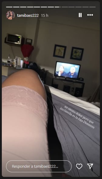 La cirugía estética de Tamara Báez