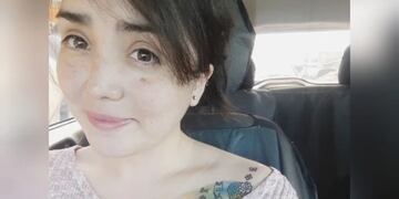 Fanny Miranda tiene un tumor cerebral y pide ayuda a través de las redes para poder viajar a Buenos Aires