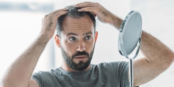 Las causas mas frecuentes de la caída del cabello son estrés, genética e hipotiroidismo.