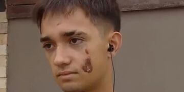 Demián Páez quedó con múltiples golpes en el rostro y en el cuerpo.