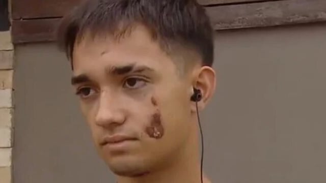 Demián Páez quedó con múltiples golpes en el rostro y en el cuerpo.