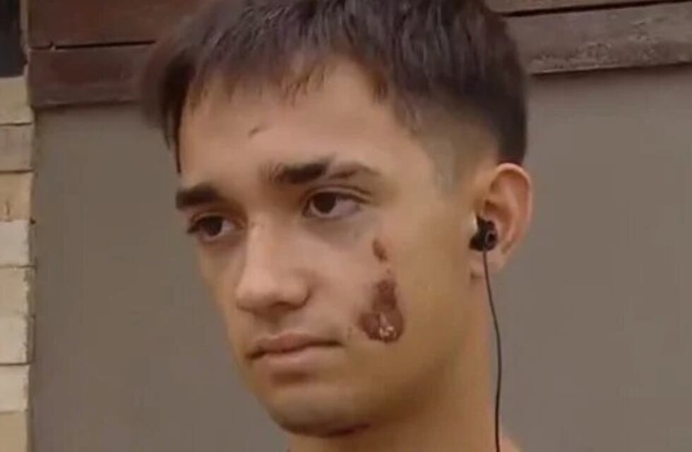 Brutal golpiza a la salida de un boliche en Cañuelas: “Me decían que estaba muerto y se burlaban”