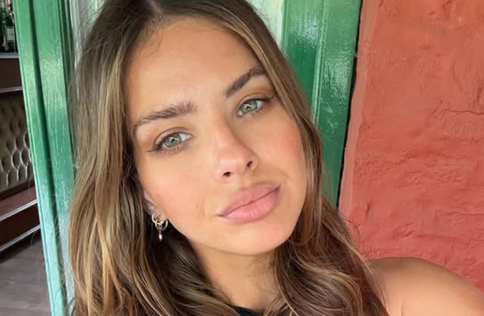 La China Suárez reveló cuál es el tratamiento estético que se hace y mostró el impactante resultado: “Láser y...”