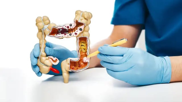 El Día Mundial del Cáncer de Colon se celebra el 31 de marzo para concienciar sobre la necesidad de tomar medidas para prevenirlo y también promover la detección precoz.