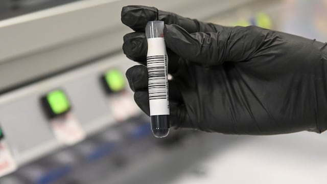 Estudios genéticos de cáncer