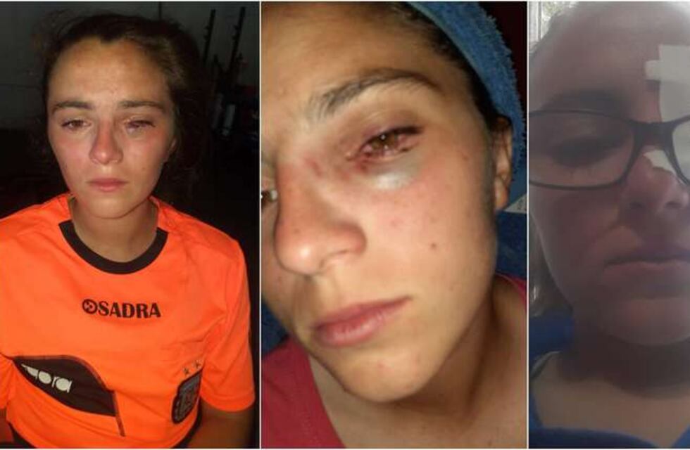 Repudiable: una árbitra de fútbol femenino fue golpeada en la cara por futbolistas