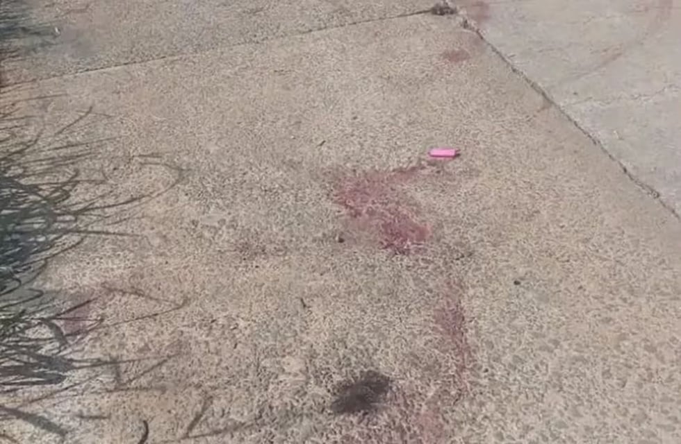 Murió una de las personas que fue atacada por tres perros pitbull en Irigoyen