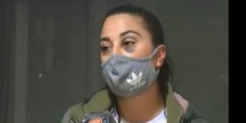 Yesica Brusa, denunció que un policía de Córdoba la golpeó en el rostro.