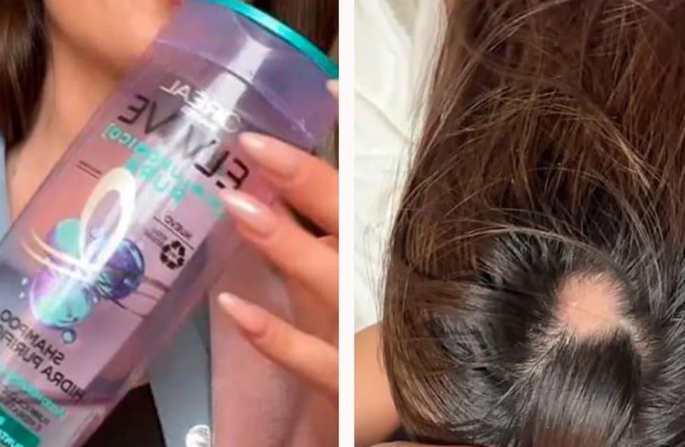 La verdad detrás del shampoo morado que se hizo viral en TikTok por “hacer caer el pelo”