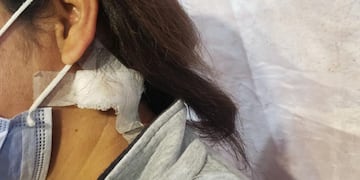 La mujer recibió el balazo en la nuca y sobrevivió de milagro.