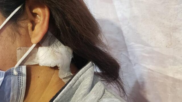 La mujer recibió el balazo en la nuca y sobrevivió de milagro.