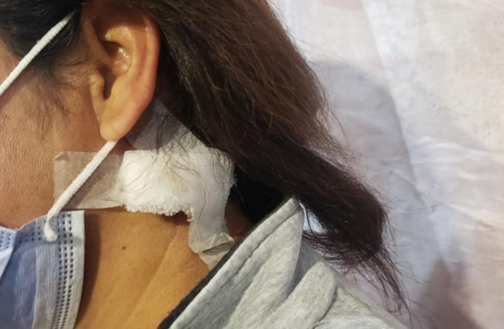 El crudo relato de la mujer baleada en la cabeza por su pareja policía en Tanti