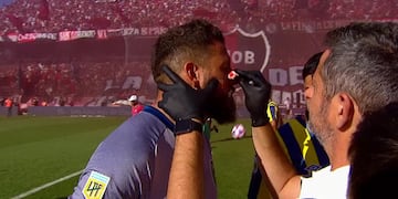 El arquero de Rosario Central, Jorge Broun, sufrió un corte en la cara antes del clásico rosarino.