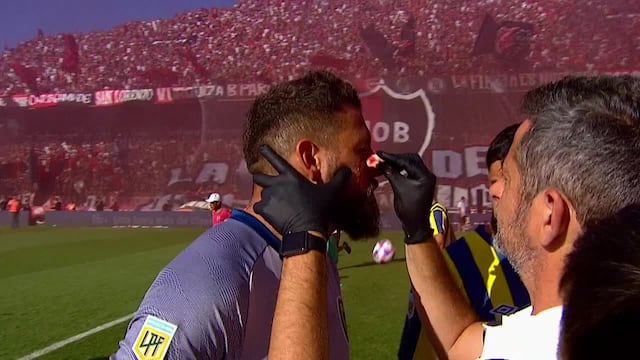 El arquero de Rosario Central, Jorge Broun, sufrió un corte en la cara antes del clásico rosarino.