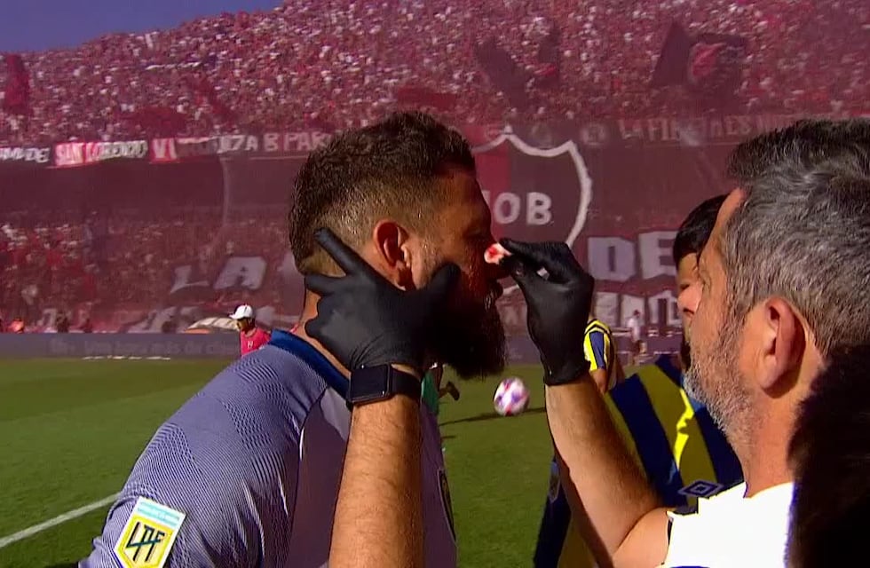 Newell’s recibió sanciones por la bomba de estruendo que lastimó a Jorge Broun en el clásico rosarino