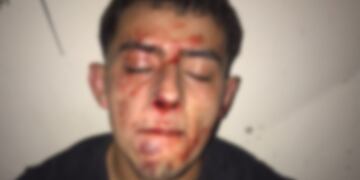 Denunció brutal golpiza por parte del patovica de un boliche