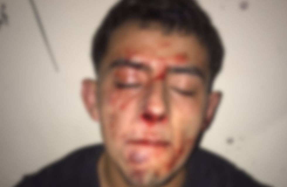 Denunció una brutal golpiza dentro de un boliche de Saldán