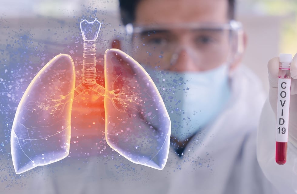 Coronavirus en Pérez: cinco casos nuevos