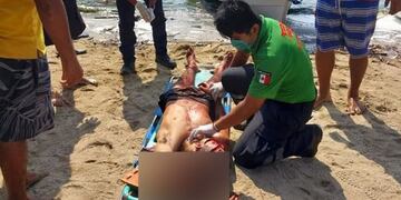 El joven recibió tres golpes en su cabeza.