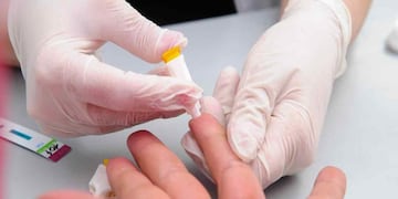 Test. Hay pruebas para la detección de VIH que facilita el diagnóstico precoz. (Télam)
