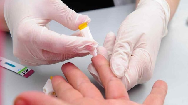 Test. Hay pruebas para la detección de VIH que facilita el diagnóstico precoz. (Télam)