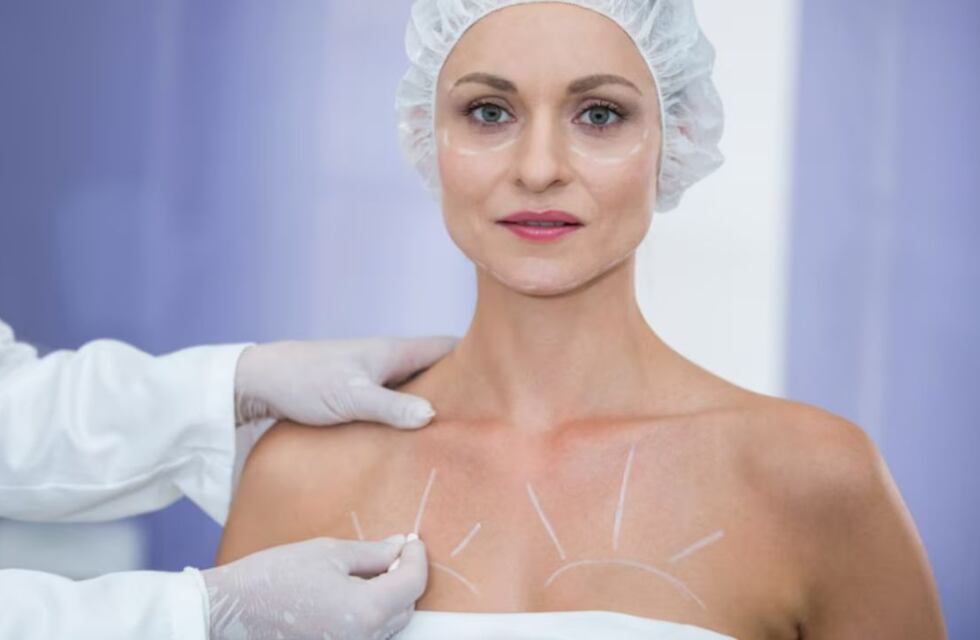 Ya no son los implantes de senos: cuál es la cirugía estética que ocupa el primer lugar