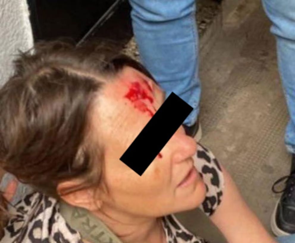 Violenta pelea en una escuela de La Plata: un exlalumno atacó a palazos e hirió a la preceptora