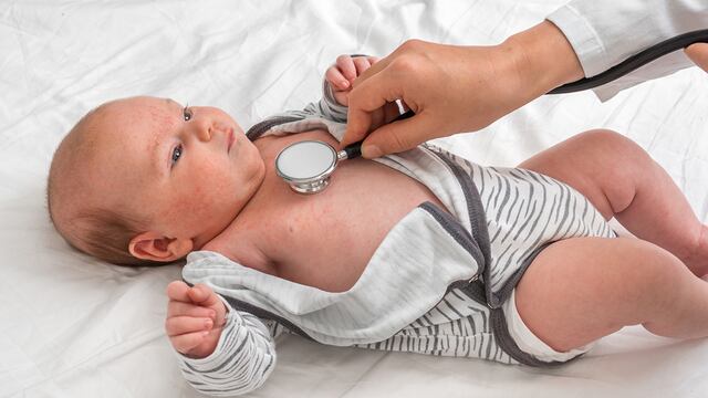 Algunas cardiopatías congénitas manifiestan síntomas inmediatamente al nacimiento y otras se presentan clínicamente meses o años más tarde / Sanatorio Allende