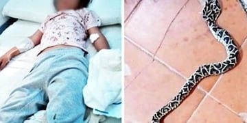 Una niña de 4 años fue mordida por una yarará mientras jugaba en una escuela de Federal