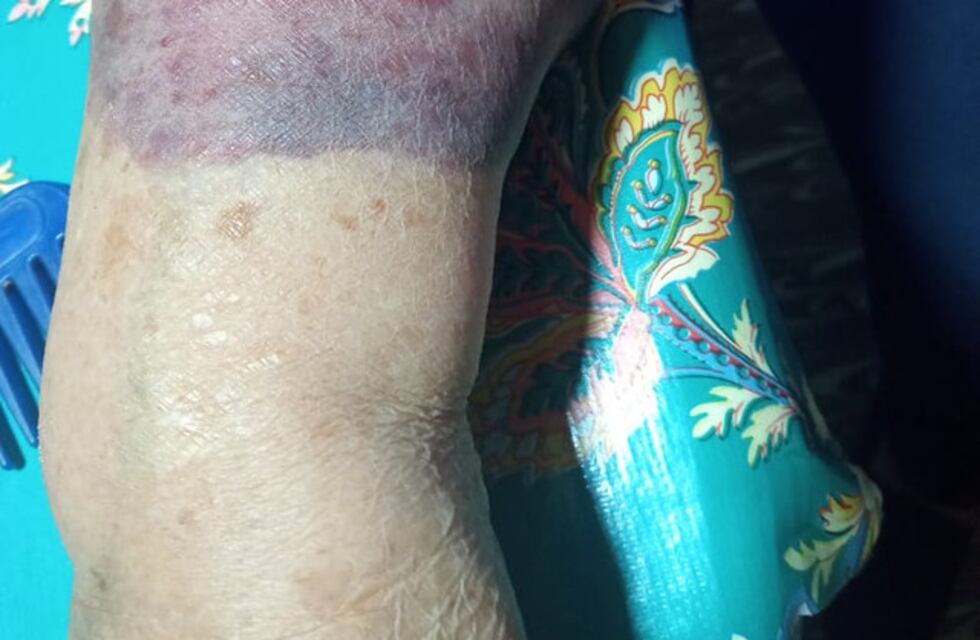 Colonia Caroya: dos detenidos por la pareja de adultos mayores golpeada en un asalto