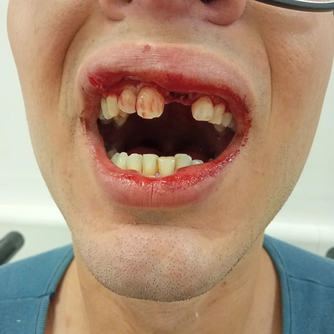 La Queen de Fuerte Apache, brutalmente agredida