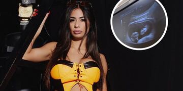 ¿Son trillizos? Daniela Celis encendió las alarmas sobre su embarazo.