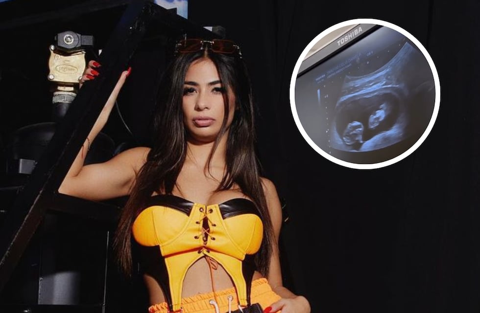 ¿Son trillizos? Daniela Celis encendió las alarmas sobre su embarazo