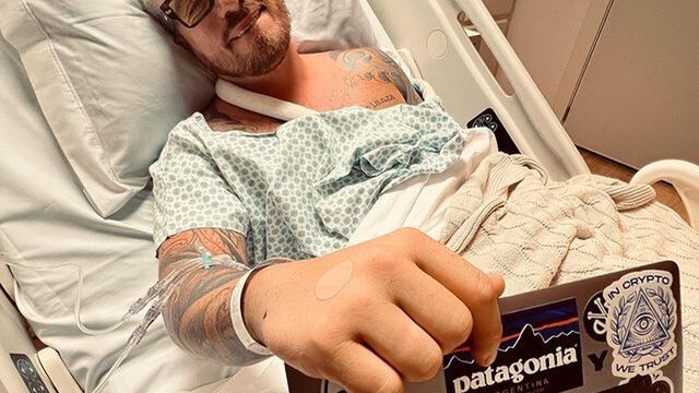 Fede Bal tras el accidente que sufrió en Brasil. (Instagram)