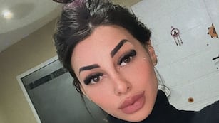 El impactante antes y después de Tamara Báez, tras la nueva cirugía estética que se hizo: “Me desperté llorando”