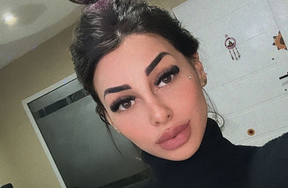 El impactante cambio de Tamara Báez, tras la nueva cirugía estética que se hizo: “Me desperté llorando”