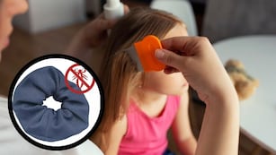 Para la Vuelta a clase: ¿Funcionan las colitas antipiojos?