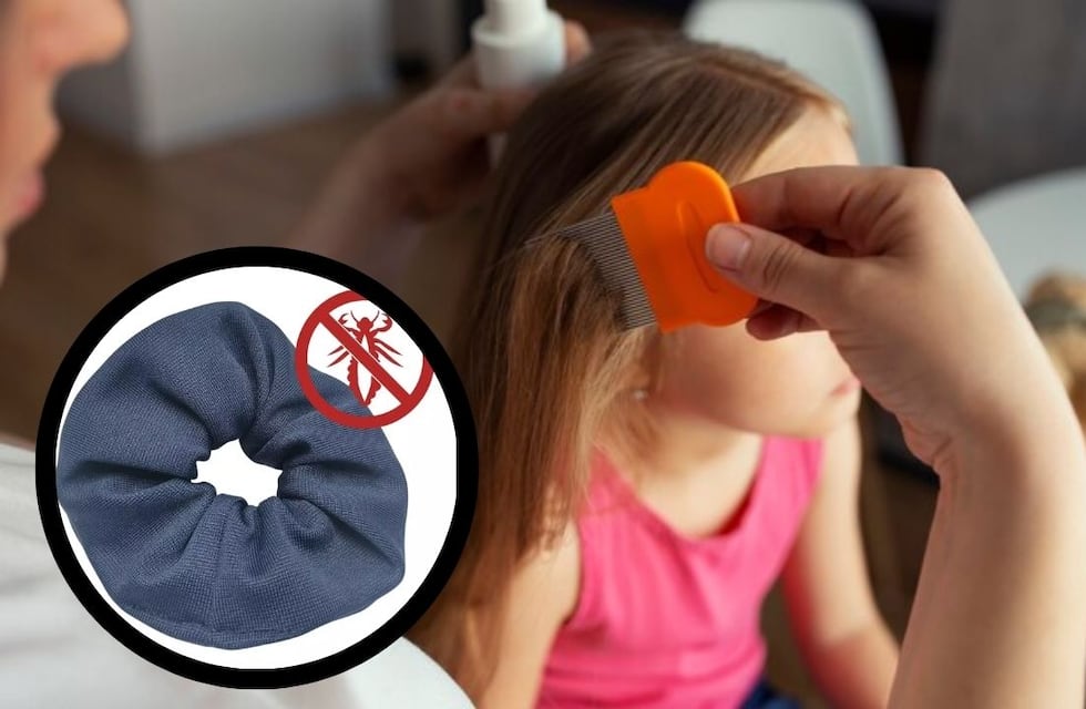 Vuelta a clases sin piojos: cómo funcionan las colitas anti piojos y qué tan buenas son