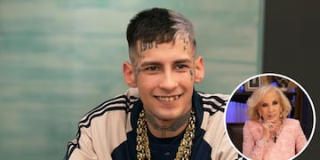 L-Gante mostró sus dientes nuevos y reveló cuánto le salió: la reacción de Mirtha Legrand