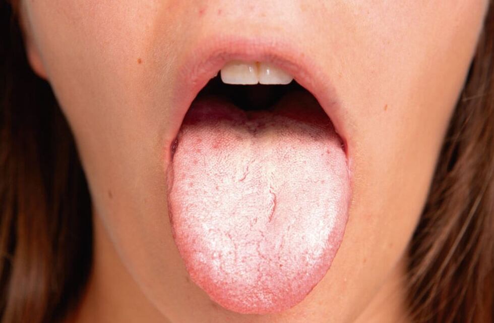 Qué significa tener la lengua blanca, según los expertos