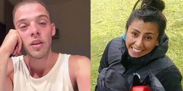 Santi Maratea ayudará a una joven rionegrina que perdió los brazos y parte de la nariz por una descarga eléctrica.