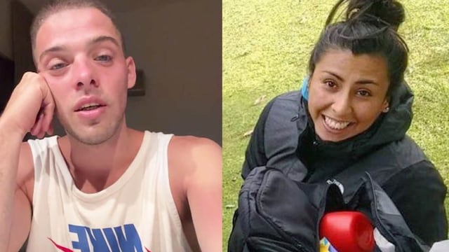 Santi Maratea ayudará a una joven rionegrina que perdió los brazos y parte de la nariz por una descarga eléctrica.