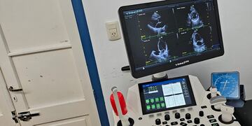 Primer Eco stress Realizado en el Hospital Municipal Anita Eliçagaray